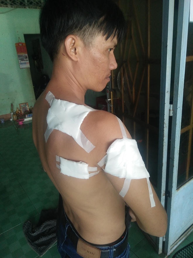 Người bán hủ tiếu hiền lành xin tha tội cho vị khách truy sát cả nhà mình