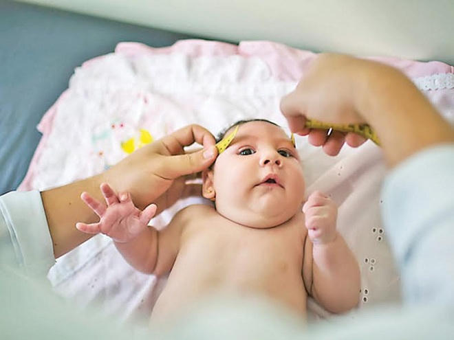 Bộ Y tế chỉ thị về phòng, chống bệnh do vi rút Zika và sốt xuất huyết