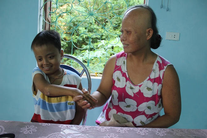 Cả gia đình tàn phế vượt lên số phận sau ngày sét đánh không chết