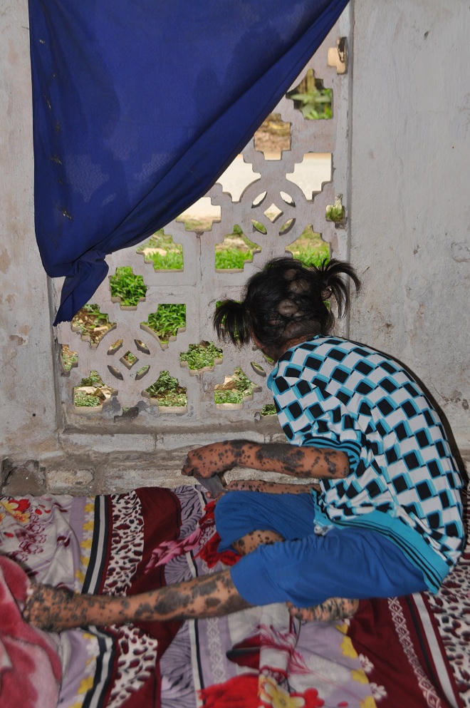 Bé gái 13 năm không ra khỏi nhà vì ám ảnh “người thú”