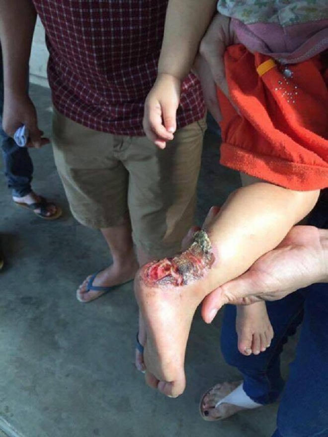 Khốn khổ gia đình chạy ăn từng bữa lại liên tiếp gặp tai ương