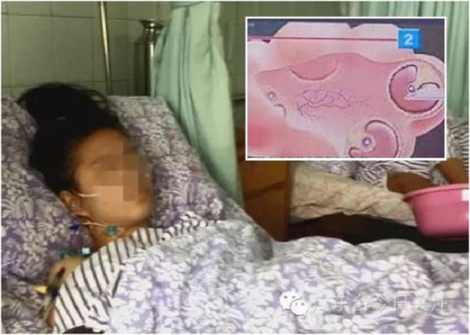 Kinh hoàng 'chợ đen' trứng nữ sinh ở Trung Quốc