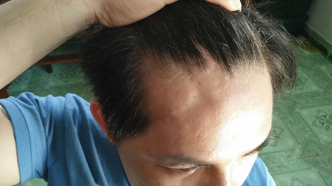 Vướng oan án vì vô tình chở “bạn nghiện” giấu ma túy