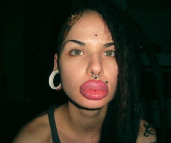 Phẫu thuật thẩm mỹ: được và mất