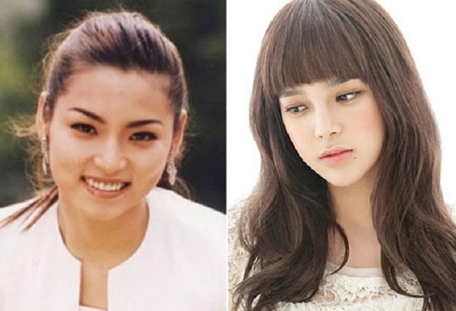 Phẫu thuật thẩm mỹ: được và mất