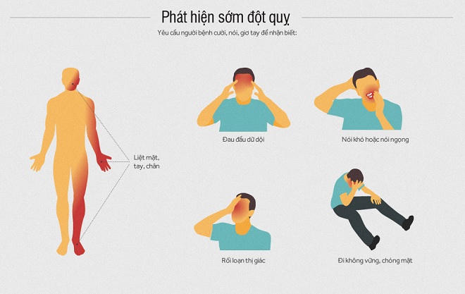 Dấu hiệu nhận biết và xử lý khi có người bị đột quỵ