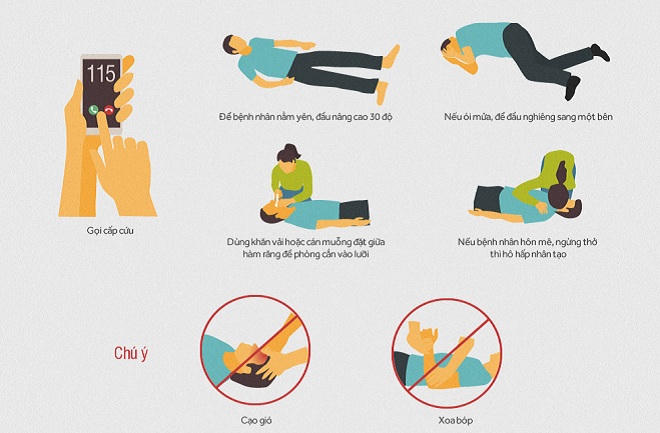 Dấu hiệu nhận biết và xử lý khi có người bị đột quỵ