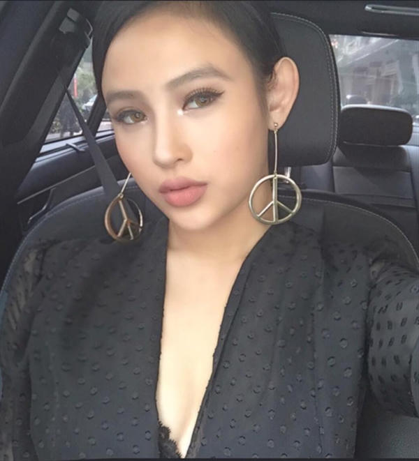 Kết quả hình ảnh cho Tiêm filler cho môi