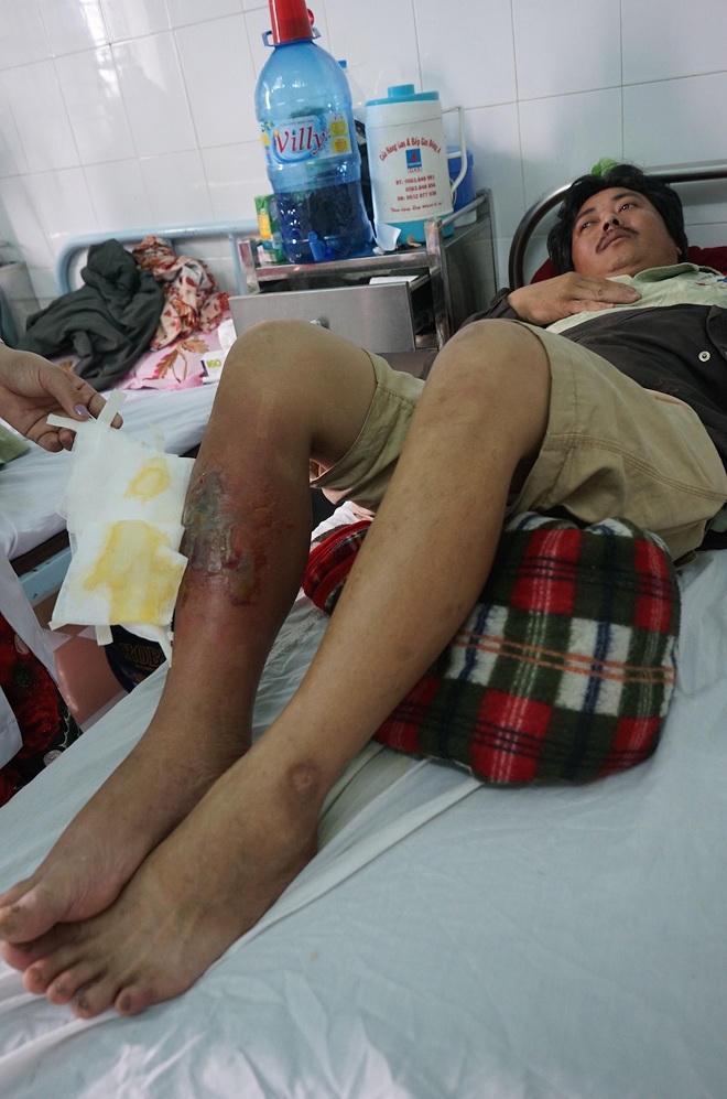 Sau lũ, nhiều người dân bị rắn lục đuôi đỏ tấn công