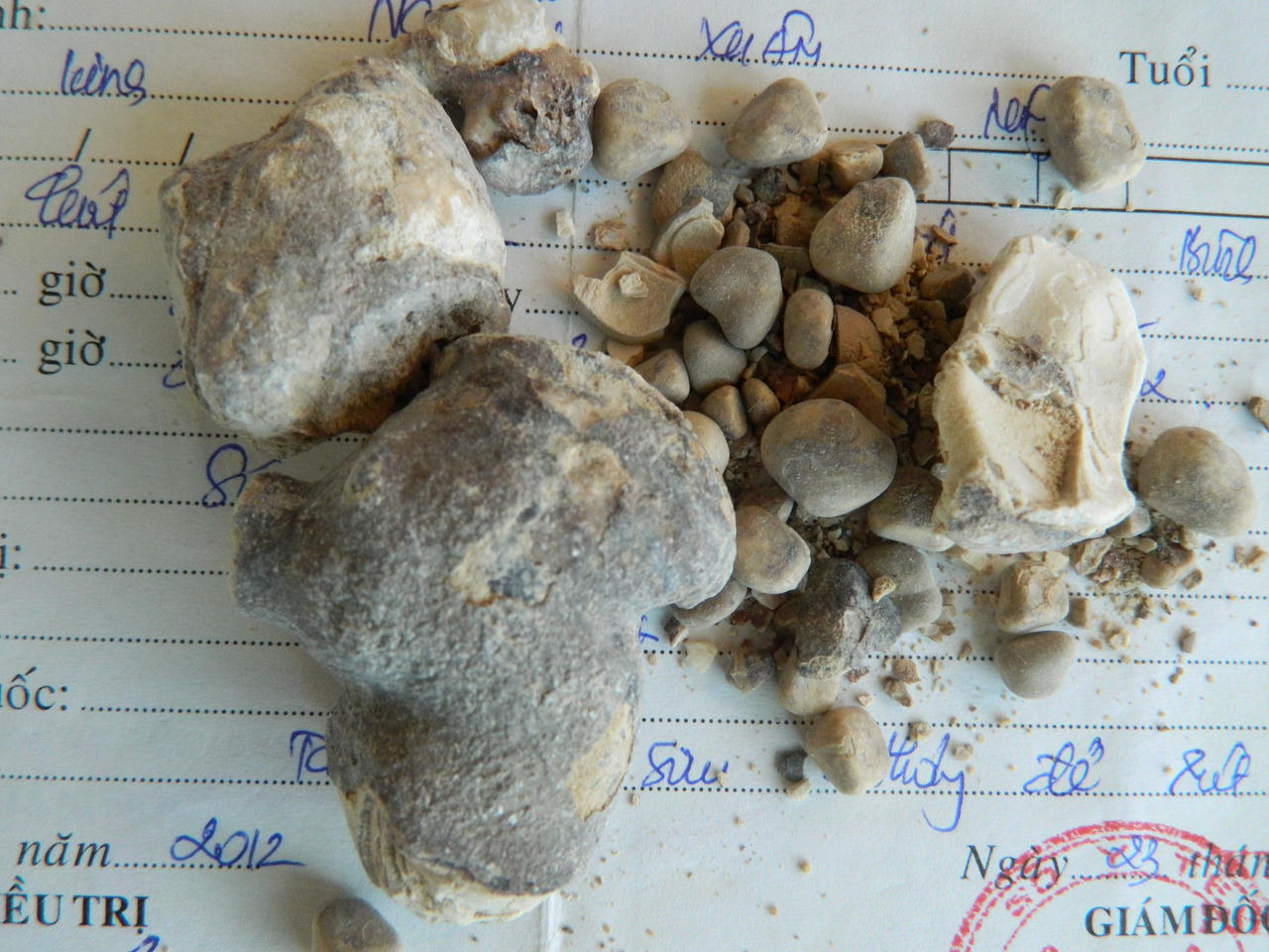 Lão nông chỉ còn một quả thận vẫn sống khỏe nhờ 4 loại cây dại