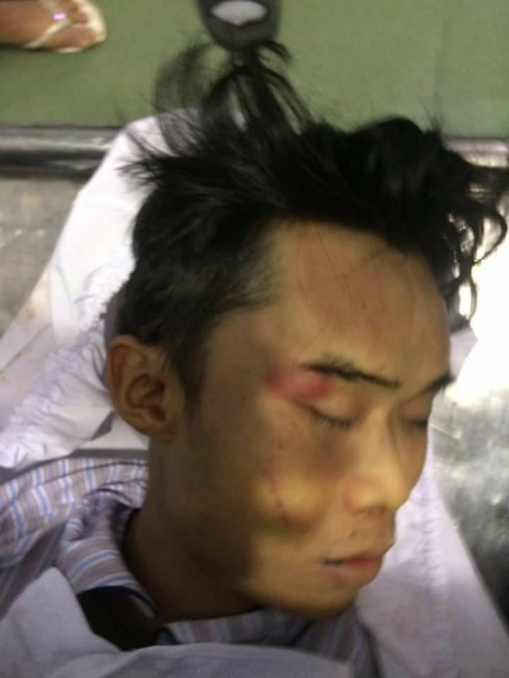 TP HCM: Nam thanh niên thiệt mạng vì bị đánh, hay tự ngã từ mái nhà xuống đất?