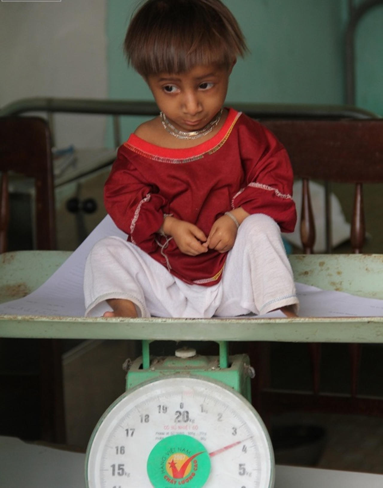 Chuyện ly kỳ về chú bé tý hon 8 tuổi cao vỏn vẹn 50cm