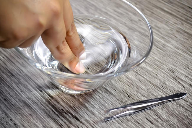 Cách lấy dằm trong tay chỉ trong nháy mắt