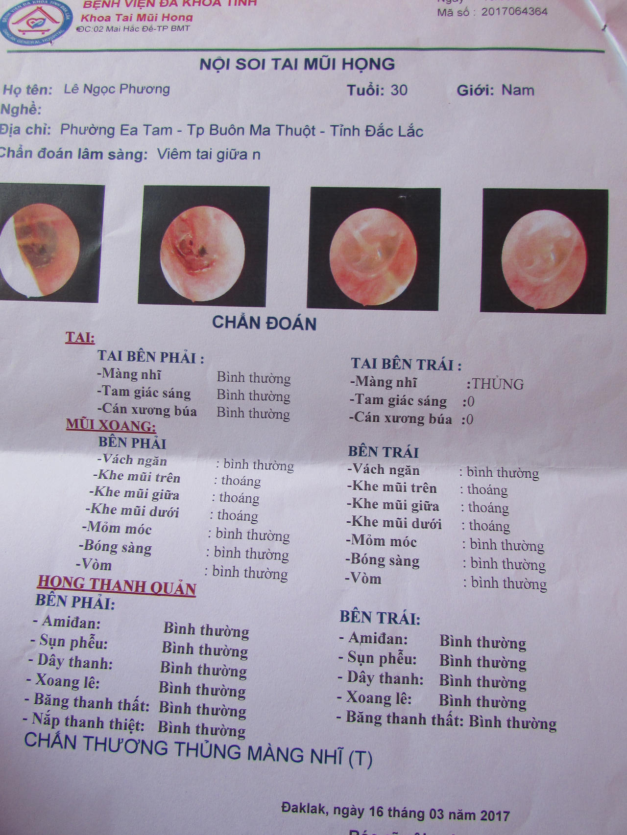 Công an phường vô cớ “tống” người dân vào trung tâm bảo trợ? 
