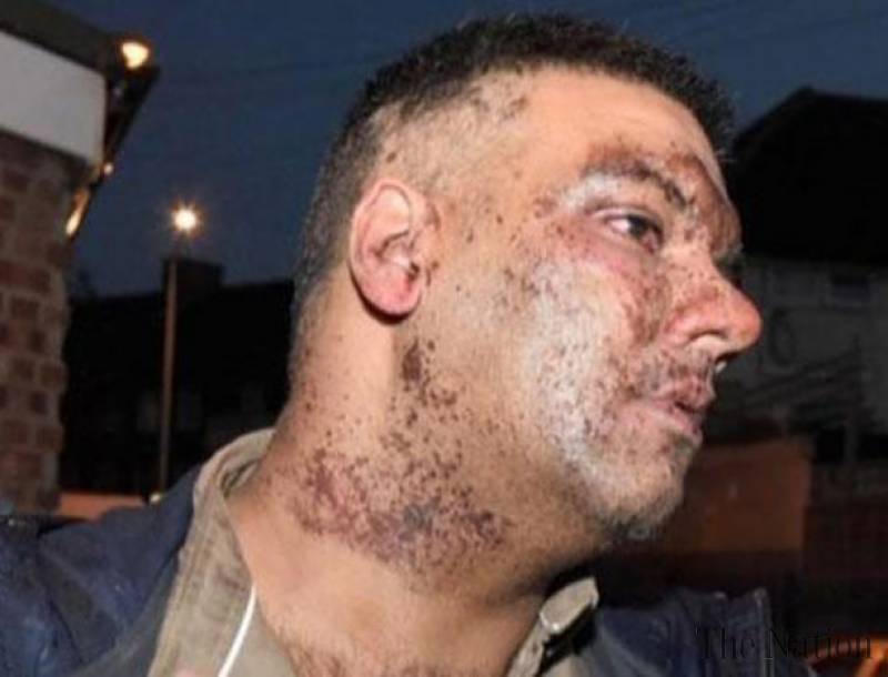 Tạt a xít - ám ảnh kinh hoàng của người dân nước Anh