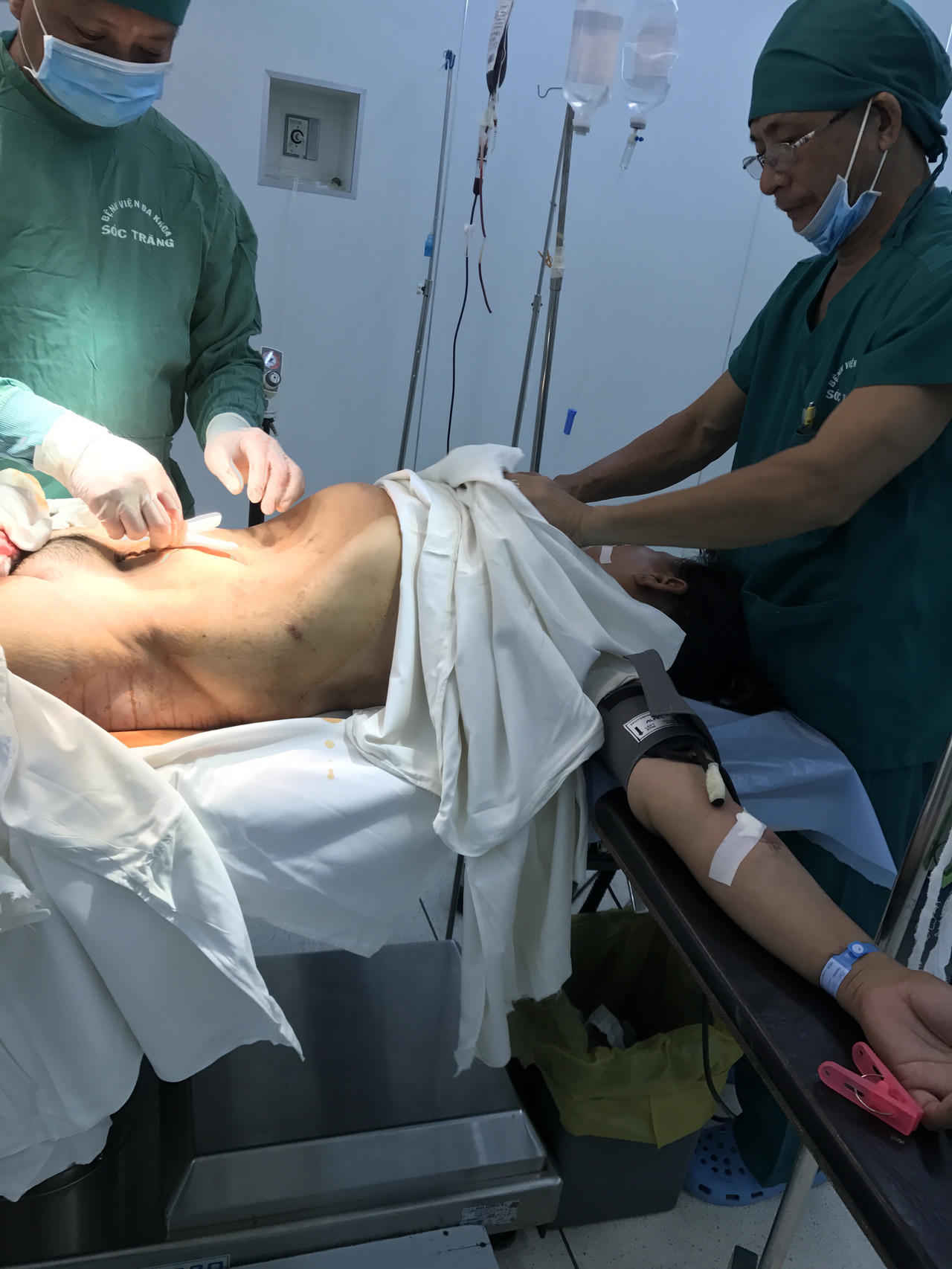 Sóc Trăng: Phẫu thuật thành công người đàn bà mang khối u buồng trứng nặng 20 kg 