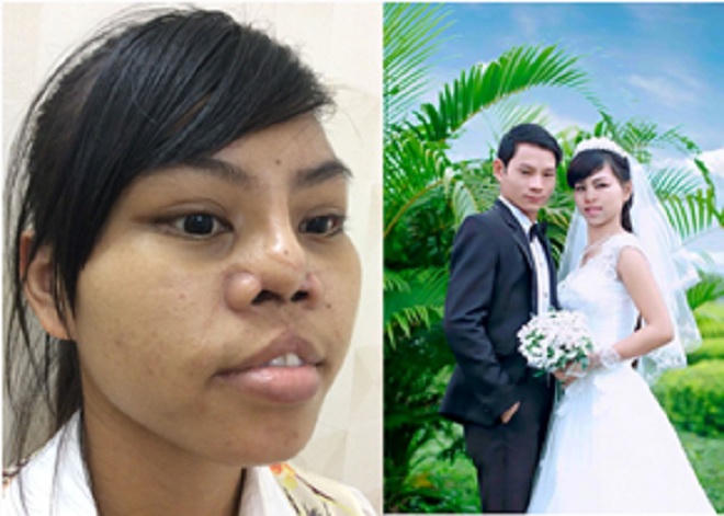 Tổ hợp thẩm mỹ 5 sao Hoàng Tuấn gìn giữ sắc xuân