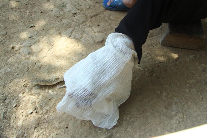 Cô gái mắc trọng bệnh muốn hiến tạng