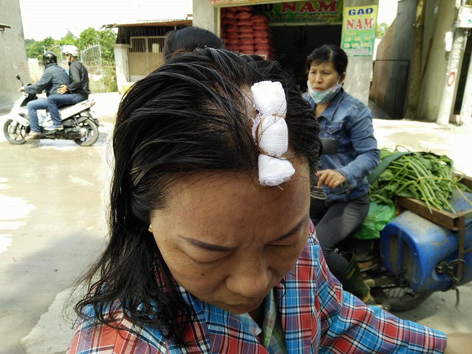 Tạt axit cả gia đình hàng xóm tại Đồng Nai: Chính quyền ở đâu? 