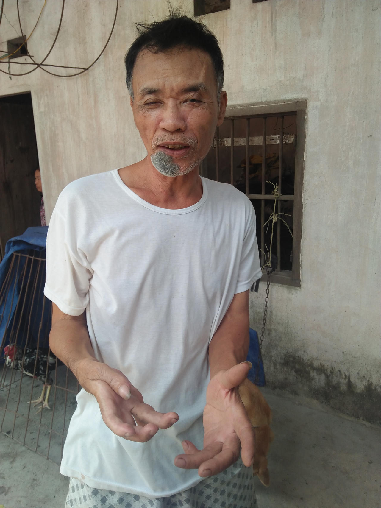 Mâu thuẫn về món nợ 3,6 triệu, "chủ nợ" bị đuổi chém đến tàn phế