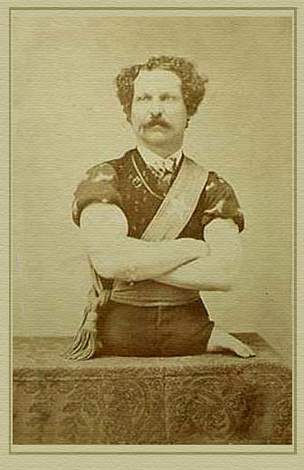 Chuyện những dị nhân khuyết tật làm điều phi thường trên thế giới