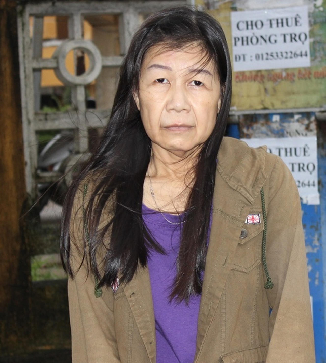 Ngỡ ngàng trước cô gái mang gương mặt bà lão sau khi phẫu thuật