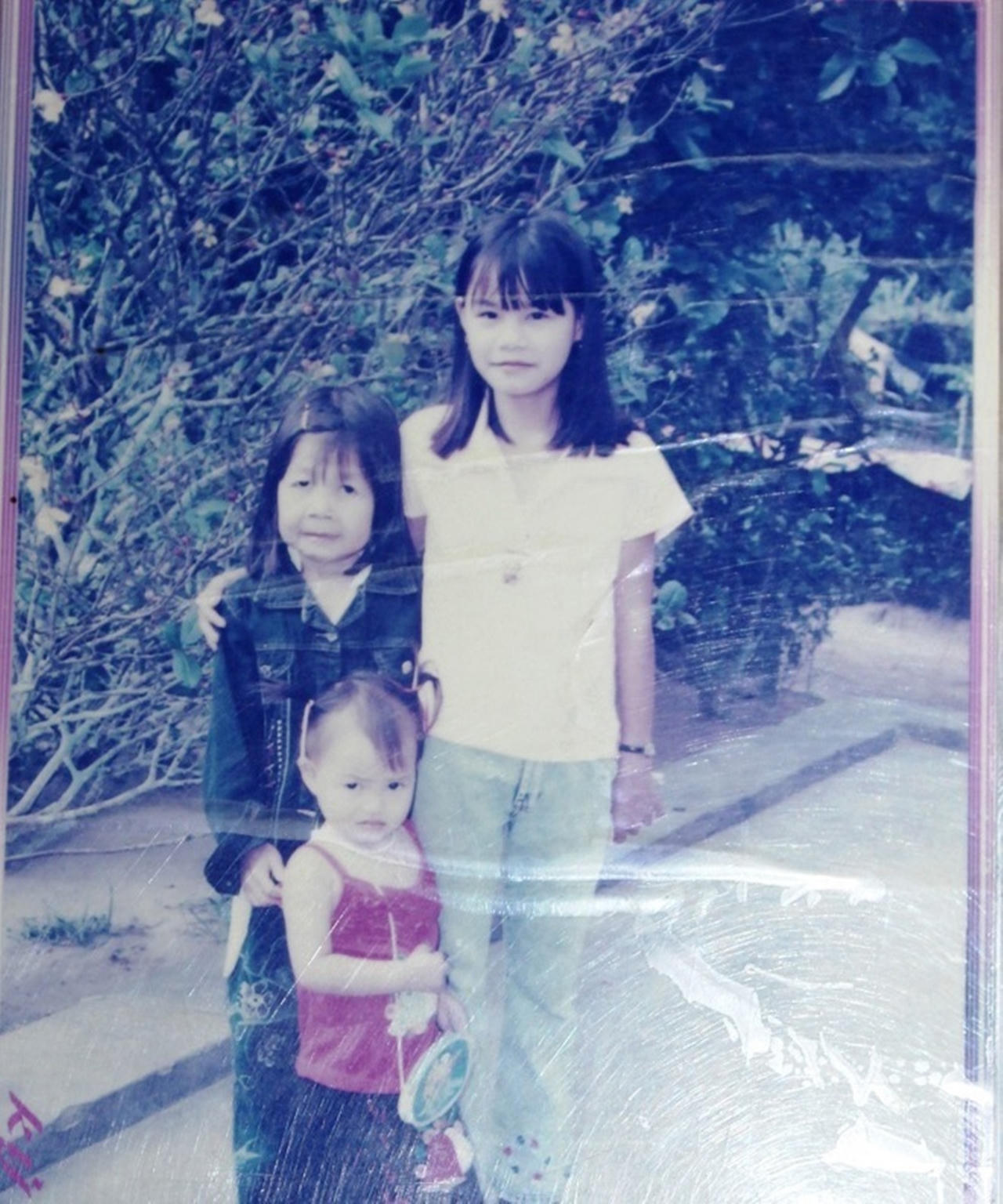 Ngỡ ngàng trước cô gái mang gương mặt bà lão sau khi phẫu thuật