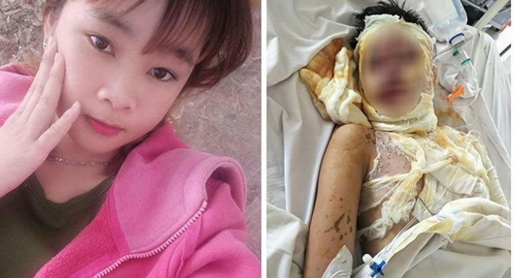 Cần Thơ: Yêu không thành, thuê người tạt axit hai chị em