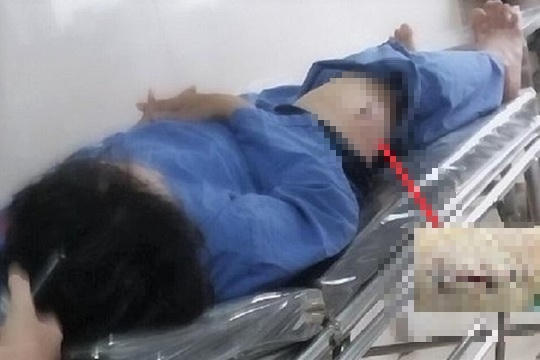 Kẻ đâm cán bộ Cục thuế Ninh Bình ra đầu thú