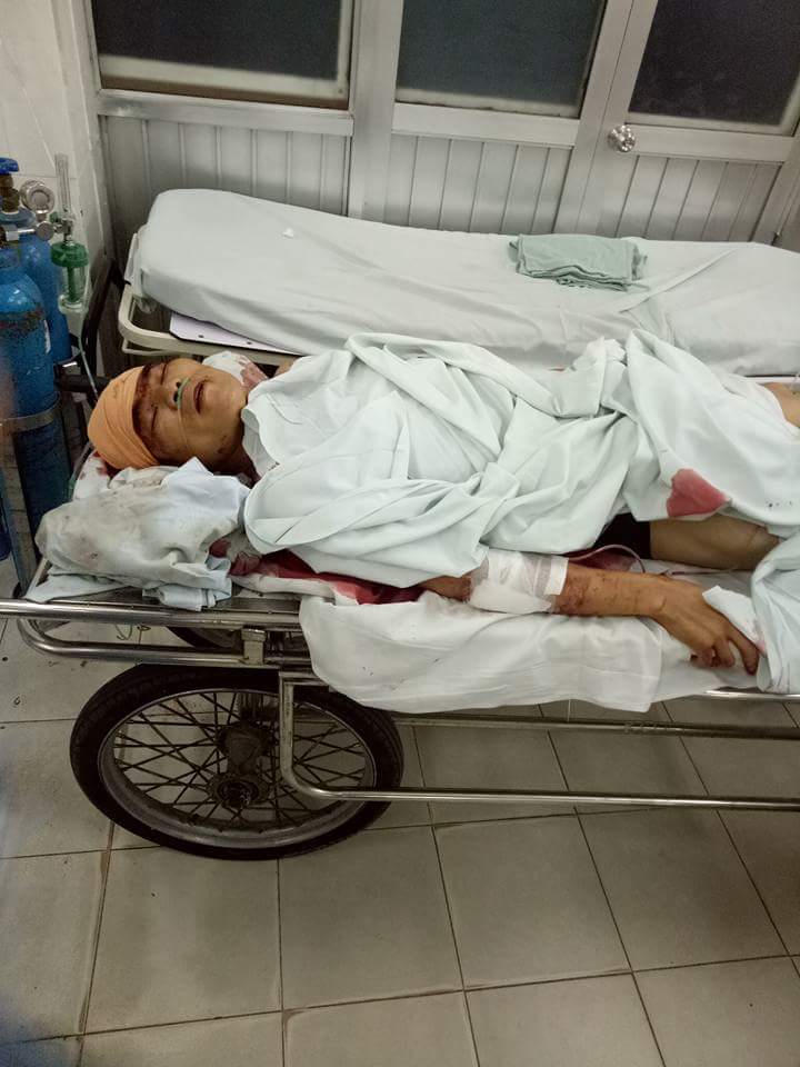 Vụ nam thanh niên bị đâm gục ở đường Võ Chí Công: Mâu thuẫn do... tè bậy