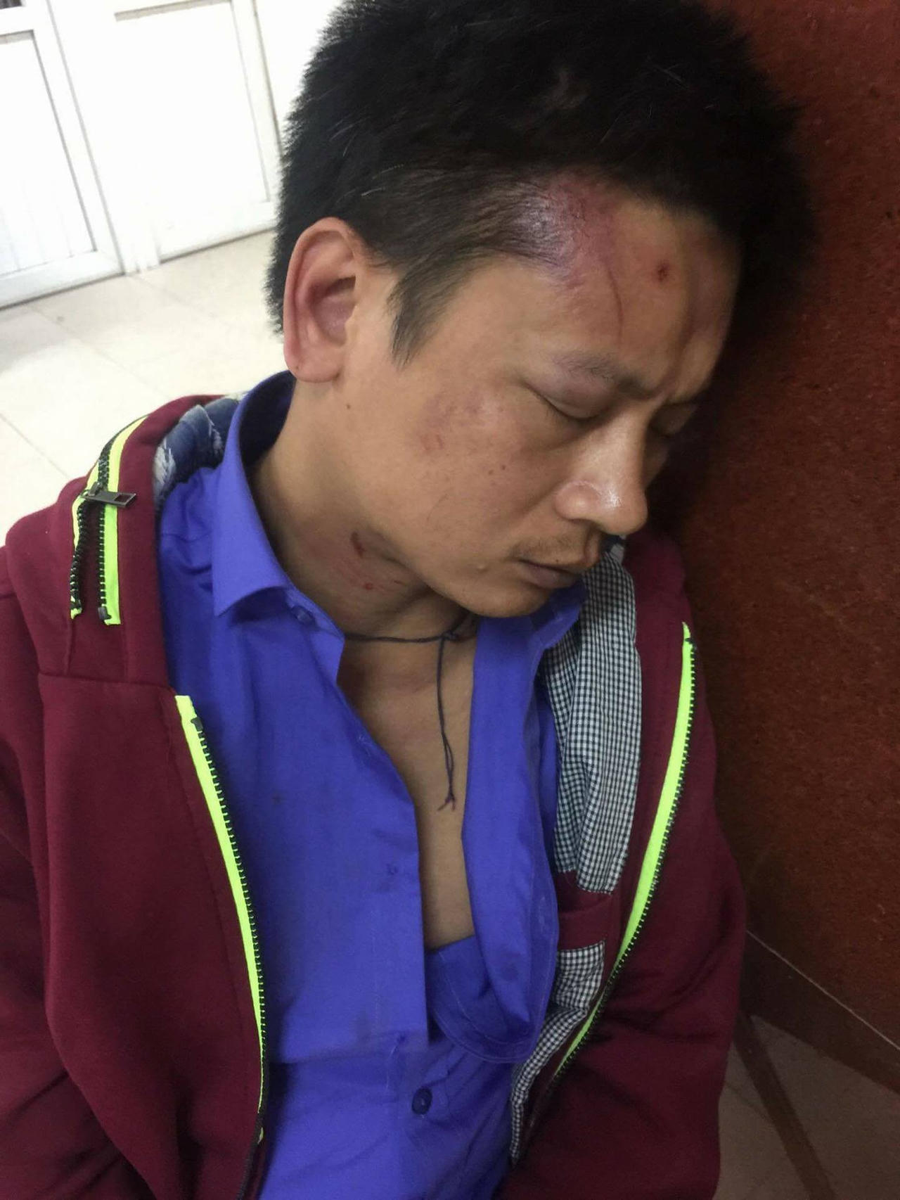 Bảo vệ bệnh viện phụ sản Hà Nội đánh người nhà bệnh nhân nhập viện