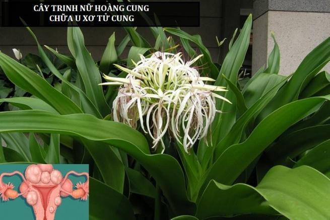 Nga Phụ Khang - Sản phẩm thảo dược được hàng triệu chị em bị u xơ tử cung tin dùng