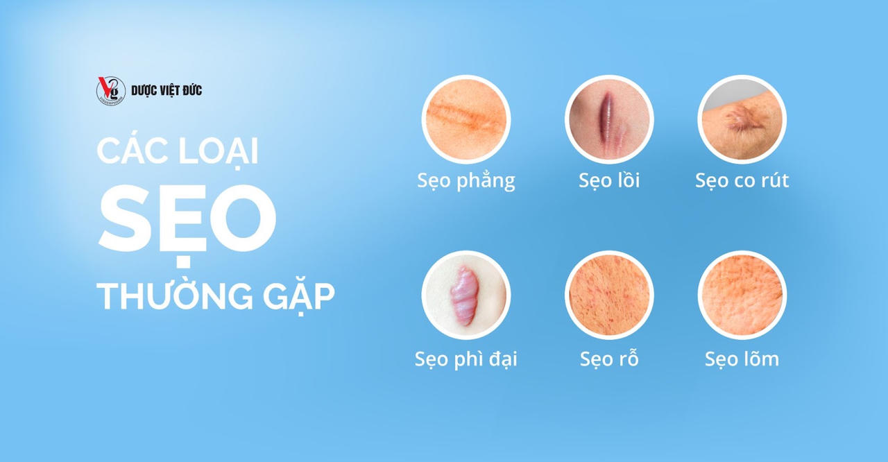 Tạm biệt sẹo, thêm tự tin khẳng định bản thân với DeCtix!