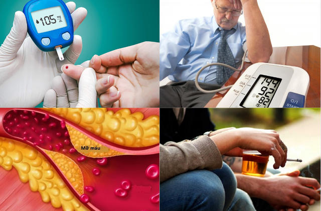 5 yếu tố khiến nguy cơ đột quỵ tăng cao và giải pháp phòng ngừa sớm 