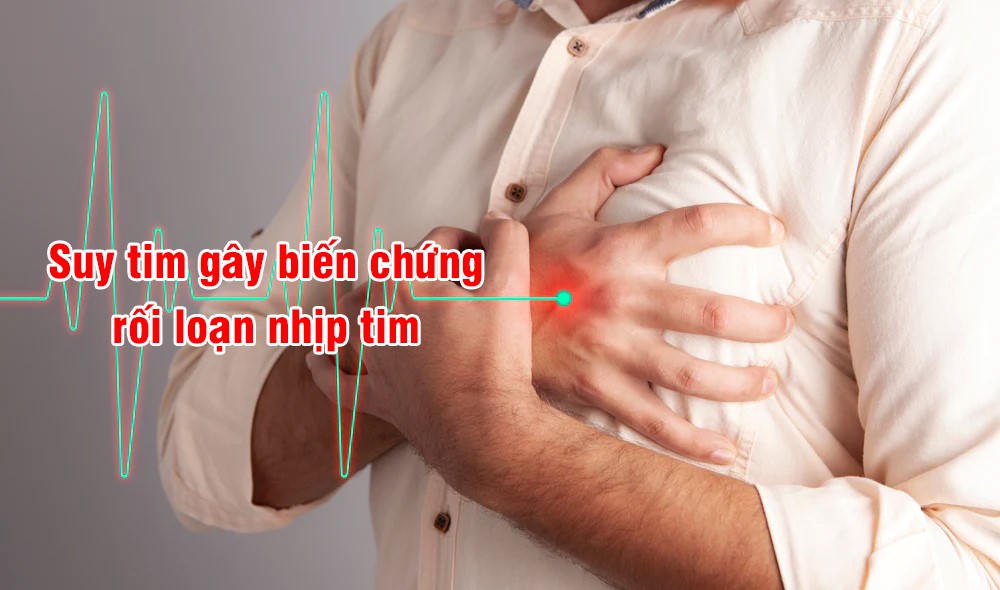 Suy tim - Hậu quả chung của các bệnh tim mạch