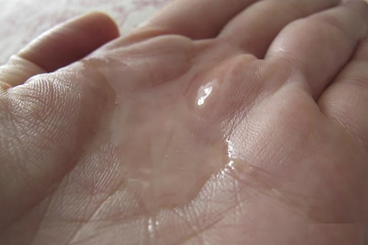 Dấu hiệu tinh trùng yếu và giải pháp cải thiện từ Linh Tự Đan