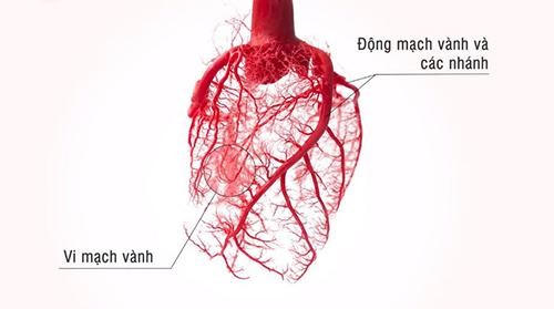 Ích Tâm Khang Platinum - Giải pháp thảo dược giúp hỗ trợ giảm đau thắt ngực, nặng ngực ở người tăng huyết áp, tiểu đường