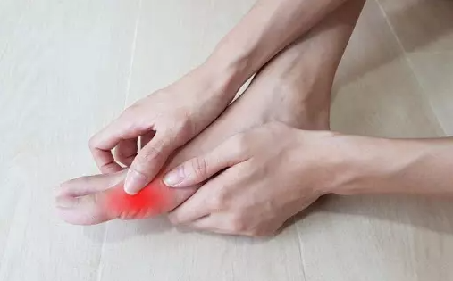 Nhận biết triệu chứng bệnh gút ở chân và giải pháp cải thiện từ Hoàng Thống Phong