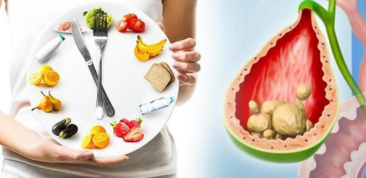 Giải pháp hỗ trợ bài sỏi mật với TPBVSK Kim Đởm Khang