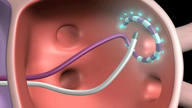 4 cách giảm nhịp tim nhanh và giải pháp từ Ninh Tâm Vương