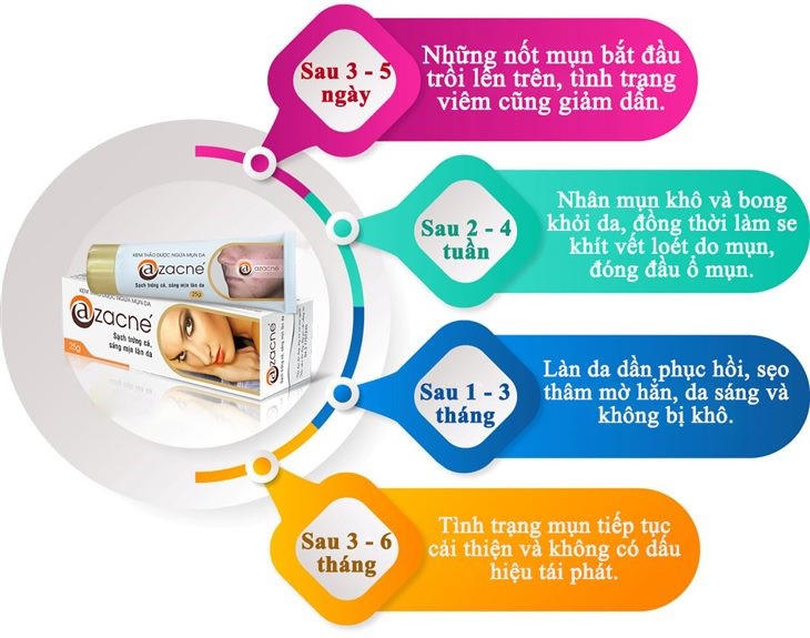 Cách trị mụn trứng cá và giải pháp từ kem thảo dược ngừa mụn Azacné