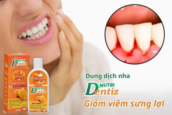 Bí quyết giảm viêm sưng lợi từ dung dịch nha Nutridentiz