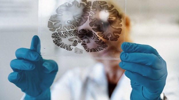 Thoái hóa chất trắng và giải pháp hỗ trợ điều trị với Vương Lão Kiện