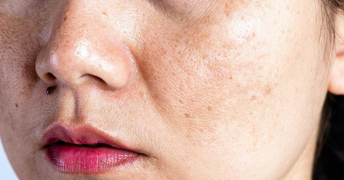 Dấu hiệu tiền mãn kinh sớm và cách cải thiện hiệu quả từ thảo dược Spacaps