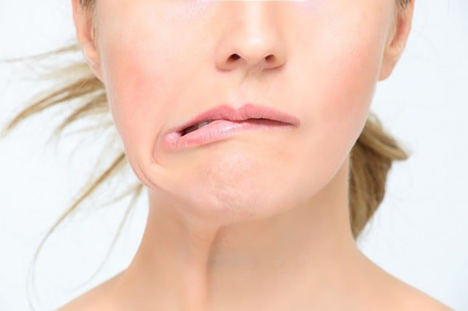 Phục hồi di chứng méo miệng, nói khó sau tai biến: Vì sao nên lựa chọn Kinh Vương Não Bộ?