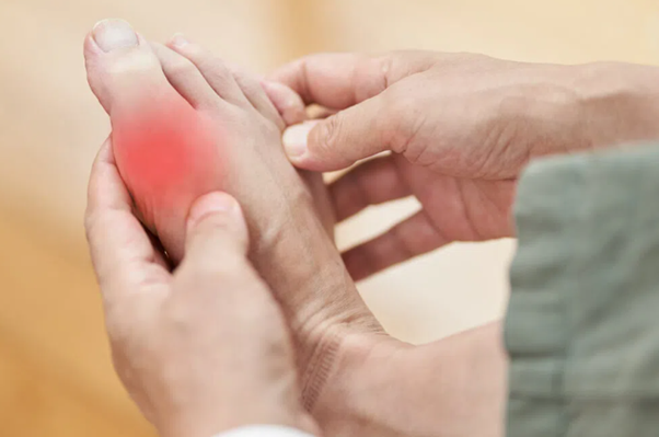 Bệnh gút - Dấu hiệu nhận biết và cách cải thiện nhờ Hoàng Thống Phong