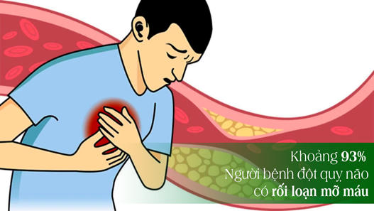 Cảnh giác nguy cơ đột quỵ não ở người bệnh mỡ máu cùng Nattospes