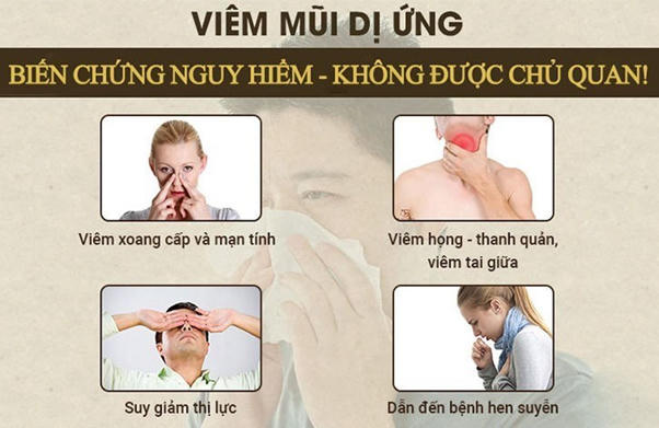 Thời tiết giao mùa, chớ chủ quan với viêm mũi dị ứng