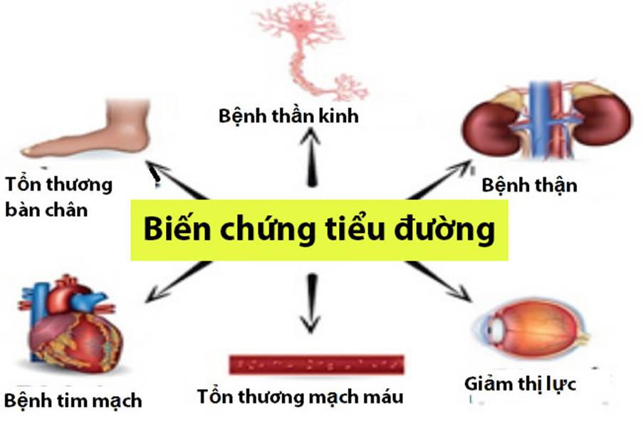 Tìm hiểu về HbA1c ở người tiểu đường và giải pháp giảm HbA1c từ thảo dược Glutex