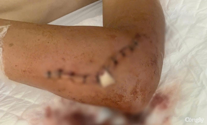 Giám đốc công ty xây dựng Thiên Quốc dùng kiếm chém chủ nợ